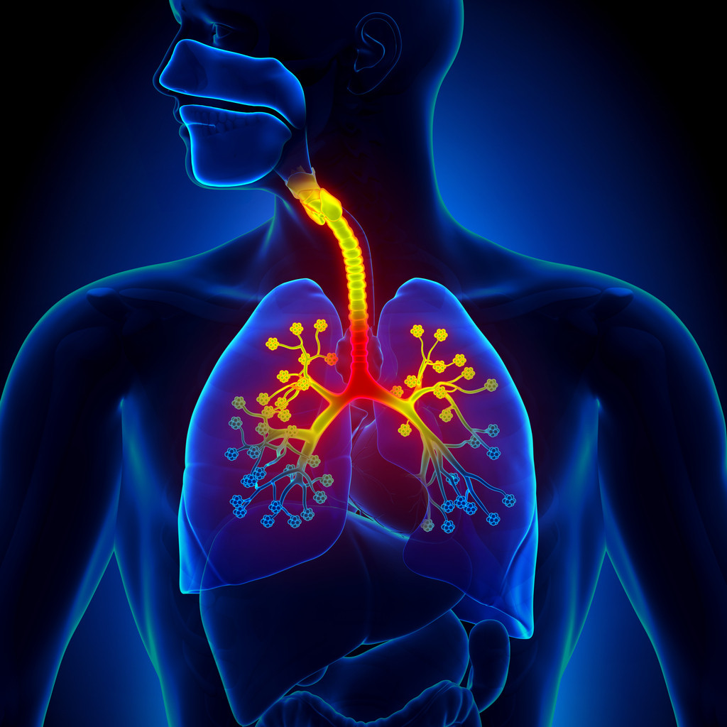 What is Bronchitis ?