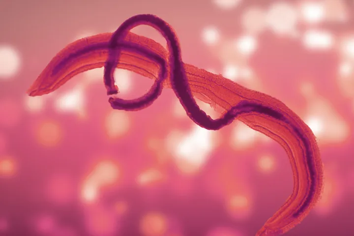 Schistosomiasis