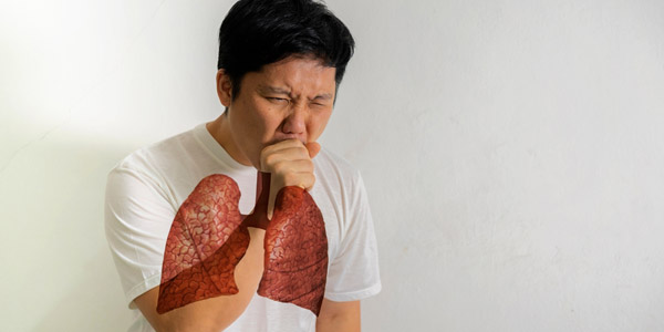 Tuberculosis
