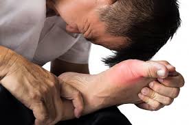 What is Gout ?